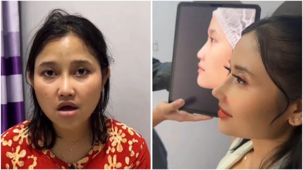 Glow Up! Diam-Diam Riyuka Bunga Mancungin Hidung, Netizen: Definisi Dendam Wanita Disakiti
