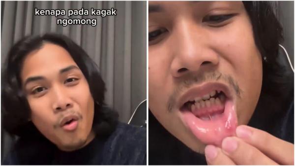 Viral Komika Bintang Emon Kritik PPN 12%:  Kenapa Pada Kagak Ngomong, Sariawan?