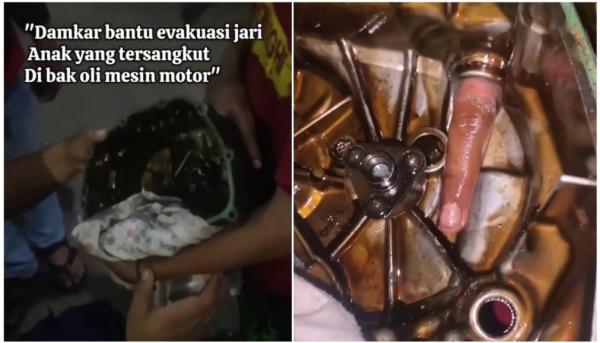 Viral! Bocah Main Servis Motor, Jari Nyangkut di Blok Mesin Endingnya Minta Tolong Damkar