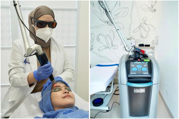Laser Pico Perawatan wajah dengan laser. (Foto: Istimewa)