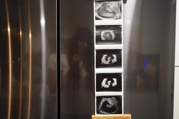 Kandungan Aurelie Moeremans. (Foto: Instagram)