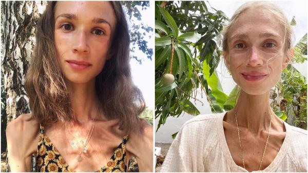 Bule Polandia tewas di Bali gegara diet ekstrem. (Foto: Instagram)