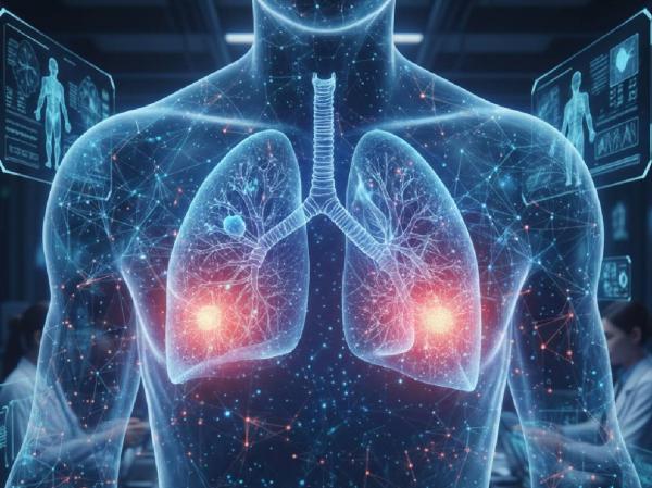 Teknologi AI Bantu Deteksi Dini Kanker Paru hingga Payudara, Ini Kata Dokter