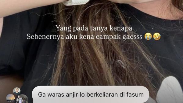 Postingan Ruce Nuenda Postingan Ruce Nuenda yang bikin netizen murka. (Foto: Instagram)