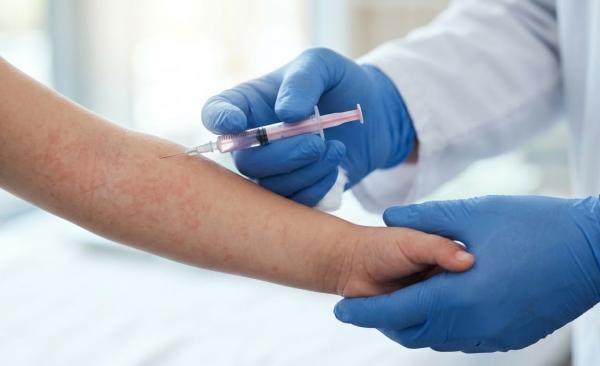 Kronologi Meninggalnya Dokter di Cianjur usai Tertular Campak saat Bertugas