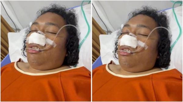Marshel Widianto nyaris meninggal dunia akibat komplikasi penyakit. (Foto: Instagram)