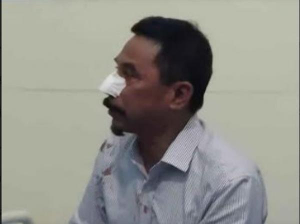Mantan Bupati Boltim Hidungnya Digigit Preman dan Disekap, Polisi: Motif Urusan Utang Saat Pilkada