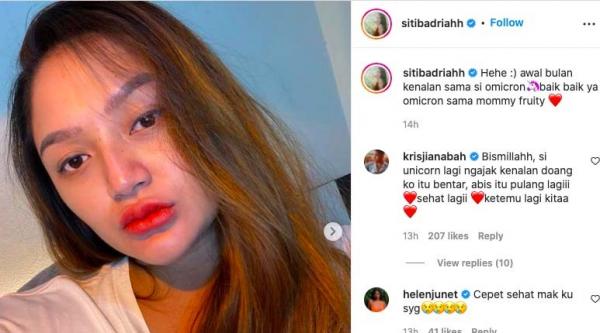 Pedangdut Siti Badriah Terpapar Omicron saat Hamil 7 Bulan, Begini Kondisinya
