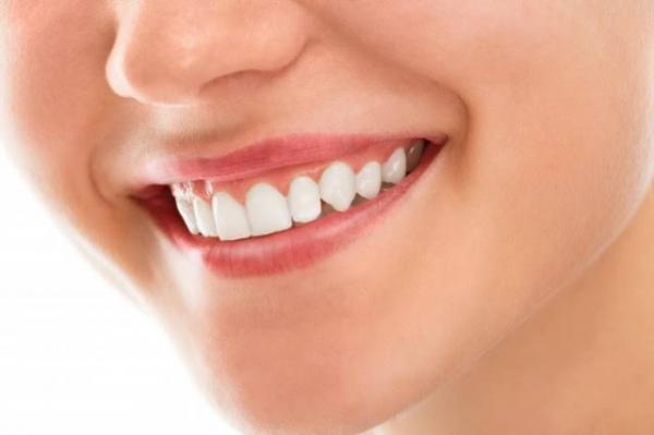 Cara Alami dan Mudah Membuat Gigi Putih, Bikin Tambah Pede