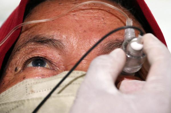 Klinik Mata dr. Sjamsu Gelar Operasi Katarak Gratis