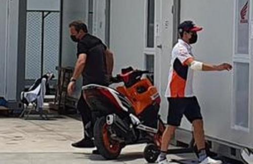 Tangan Marc Marquez Diperban, Apa akan Tampil di MotoGP Mandalika 2022