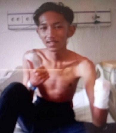 2 Remaja di Majalengka DiKeroyok 8 Orang, Tangan Kiri Korban Putus Ditebas Golok
