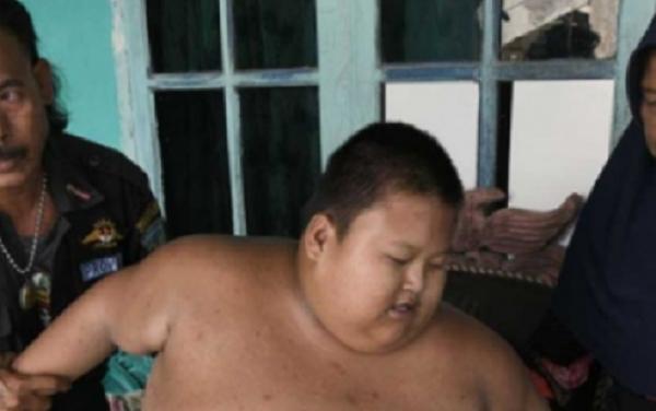 Bocah Bekasi Meninggal Setelah Berjuang dengan Obesitasnya