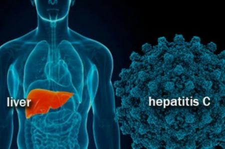 Waspadai Hepatitis Misterius, Ini yang Harus Dilakukan