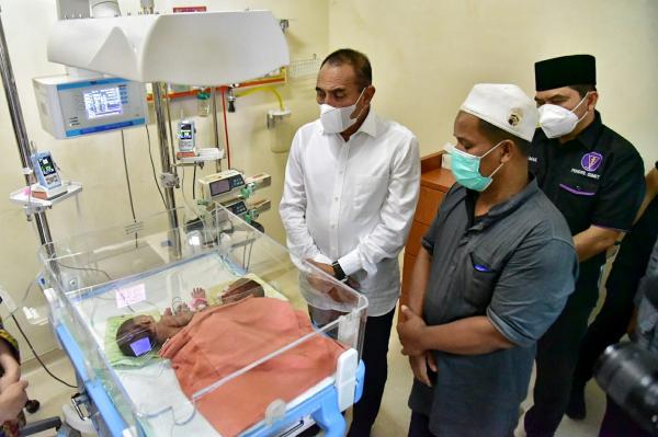 Edy Rahmayadi Jamin Biaya Perobatan Bayi Kembar Siam Ratih dan Ririn Asal Asahan