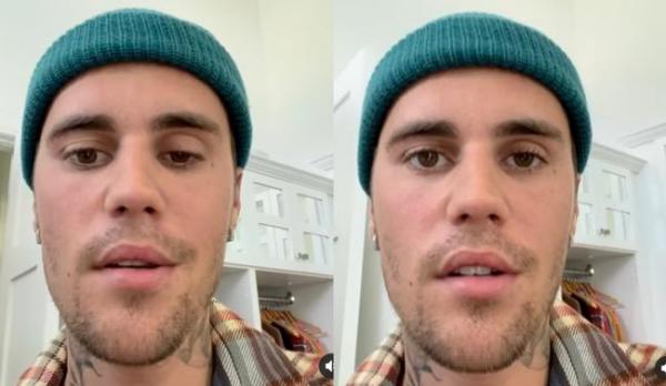 Kondisi Terkini Justin Bieber, Hingga Batalkan Tur Konser