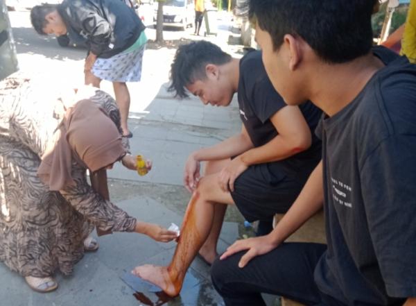 Lakalantas di Jalan Perjuangan Cirebon, Pengendara Motor Sport Terjatuh Hindari Mobil Berbelok