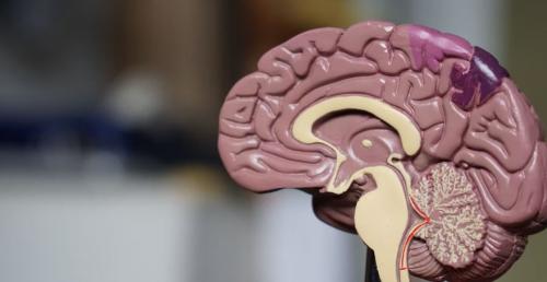 Kenali Gejala Tumor Otak, Salah Satunya Sakit Kepala Parah di Pagi Hari