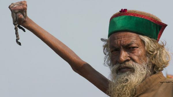 Amar Bharati, Seorang Pria di India Mengangkat Tangannya Selama 49 Tahun, Kini Tak Bisa Diturunkan