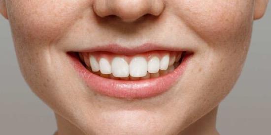 Bingung Cara Bersihkan Karang Gigi? Simak Langkahnya Berikut Ini