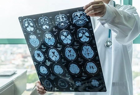 Gubernur NTT Apresiasi Langkah Siloam Hospitals Adakan Edukasi Putar Film Bedah Otak 