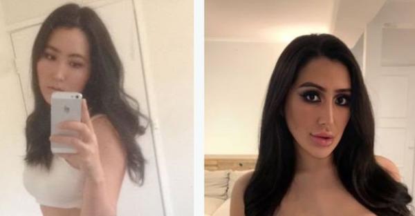 Kisah Perempuan Cantik Korea Operasi Plastik demi Mirip Kim Kardashian, Habiskan Rp877 Juta