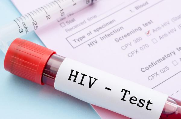Kenali Gajela HIV pada Pria, Salah Satunya Libido Rendah