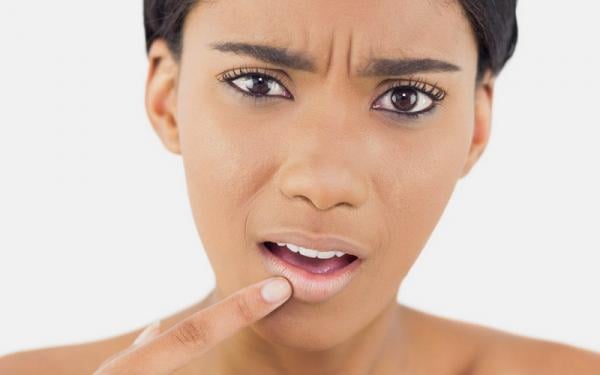 Simak 5 Cara Mengatasi Bibir Hitam Agar Kembali Cerah Secara Alami