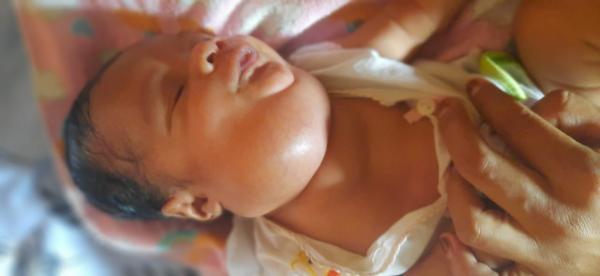 Anggota Polri di NTT Galang Dana Bantu Bayi Pengidap Higroma Colli