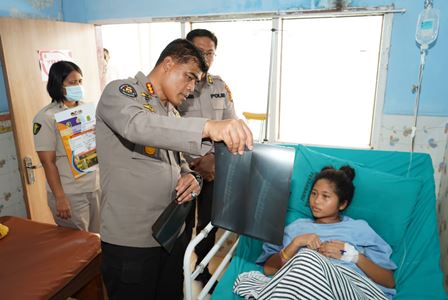 Wujudkan Asa Kembali Bersekolah, Tim Medis Polda Riau Lakukan Operasi Kaki Mitha