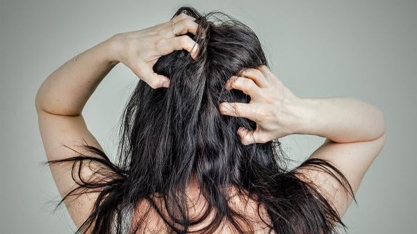 Atasi Kutu di Rambut Membandel, Berikut 5 Cara Untuk Mengatasinya