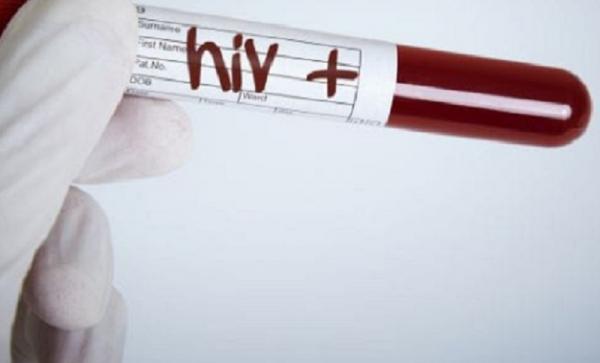 Melonjak Tajam Kasus HIV di Kabupaten Pandeglang, Akibat Seks Bebas dan Jarum Suntik
