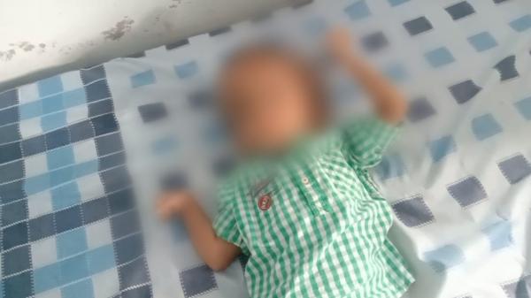 Anak Penderita Hidrosefalus Tak Bisa Berobat, Anggota DPRD Garut : Sudah Dianggarkan
