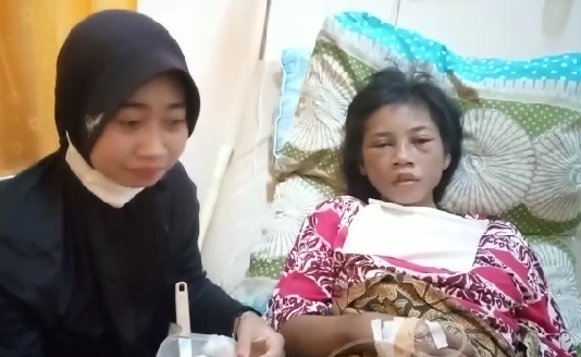 Kejam! ART asal Pemalang Diduga Dianiaya Majikan di Jakarta, Pulang Kampung Sekujur Badan Luka Lebam