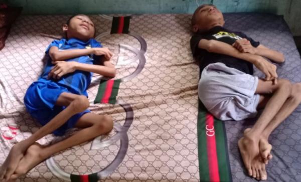 Menteri Sosial akan Temui Dua Anak Penyandang Disabilitas dari Manggarai Timur