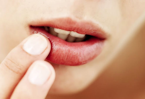 Sering Alami Bibir Pecah-pecah? Begini 6 Tipsnya Agar Bibir Tetap Sehat dan Cantik