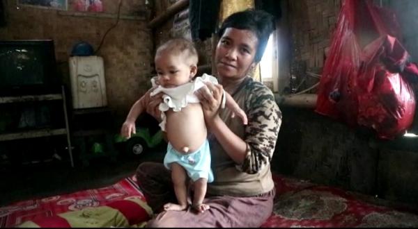 Balita di Kecamatan Labuan Derita Gizi Buruk, Orang Tua : Pinginnya Ada yang Membantu Kami