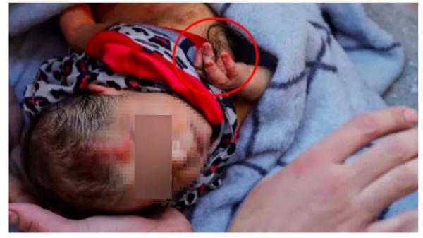 Bikin Nangis! Bayi Usia 20 Hari Selamat dari Gempa Turki, Tangannya Pegang Rambut Ibu yang Tewas