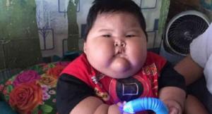 Bikin Resah Netizen Bocah Berusia 1 Tahun Mengalami Obesitas, Ini Penyebabnya