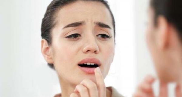 10 Cara Mengatasi Bibir Kering secara Alami, Praktis dan Manjur!