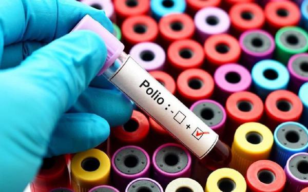 Cakupan Imunisasi Polio di Sumedang Capai 98,47 Persen