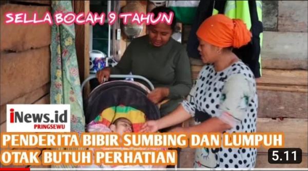 Video Bocah 9 Tahun Penderita Bibir Sumbing dan Lumpuh Otak
