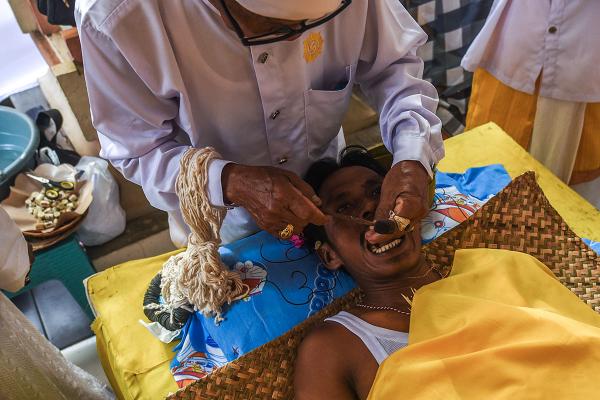 Potret Metatah, Upacara Potong Gigi Umat Hindu di Pura Agung Sriwijaya Palembang 