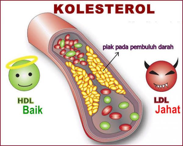 Berikut Cara Menurunkan Kolesterol Secara Alami 