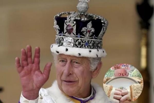 Mengenal Daktilitis, Penyakit yang Bikin Jari Raja Charles III Bengkak Mirip Sosis