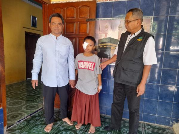 Kisah Pilu Bocah Penderita Tumor Mata asal Nganjuk,  Kemensos Beri Bantuan Operasi Gratis