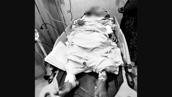 Sakit Hati Dilaporkan ke Polisi, Suami di Kutai Kartanegara Tikam Istri hingga Kritis