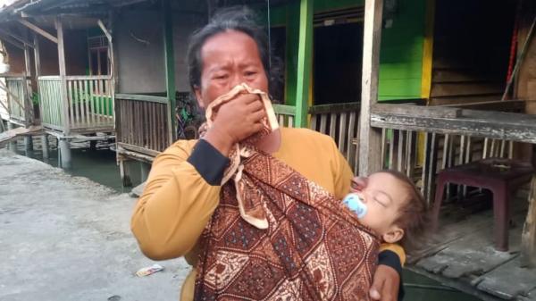 Kisah Pilu Balita Tunanetra di Batu Bara, Butuh Bantuan untuk Biaya Pengobatan