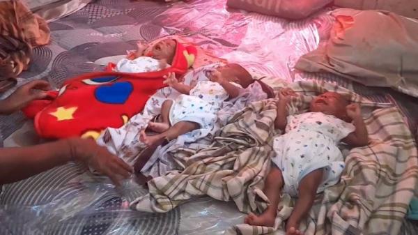 Ajaib, 3 Bayi Kembar Lahir di Alor NTT, Salah Satunya dengan Kelamin Sudah Disunat