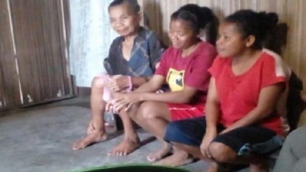Kisah Kelam Dua Remaja Putri asal Timor Tengah Utara, Ditinggalkan Orangtua sejak Balita